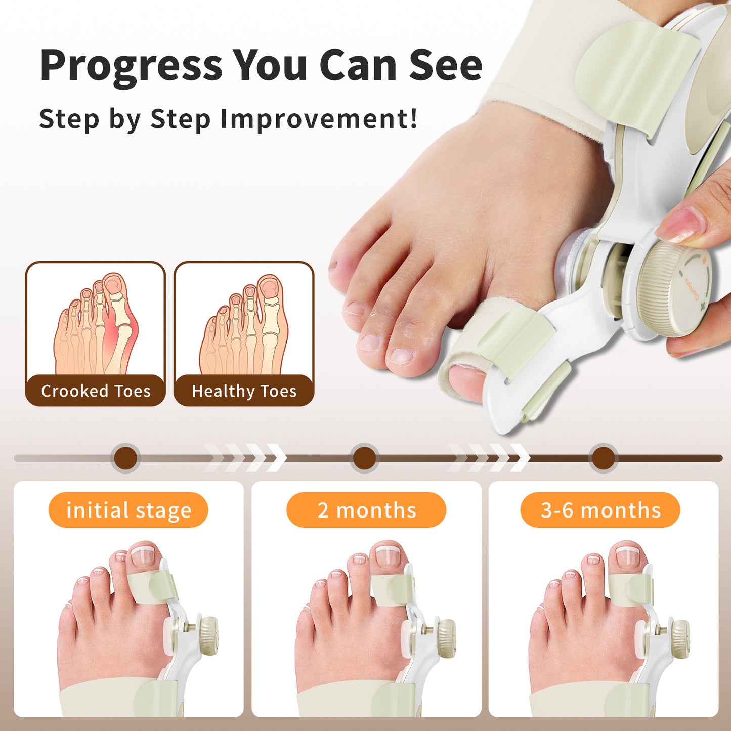 Bunion Corrector