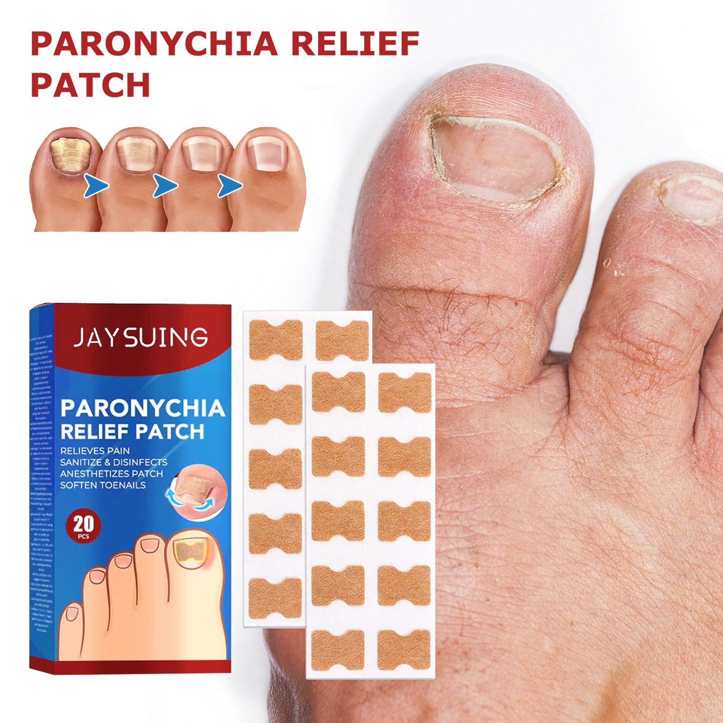 Nail Groove Nursing Adhesive Bandage