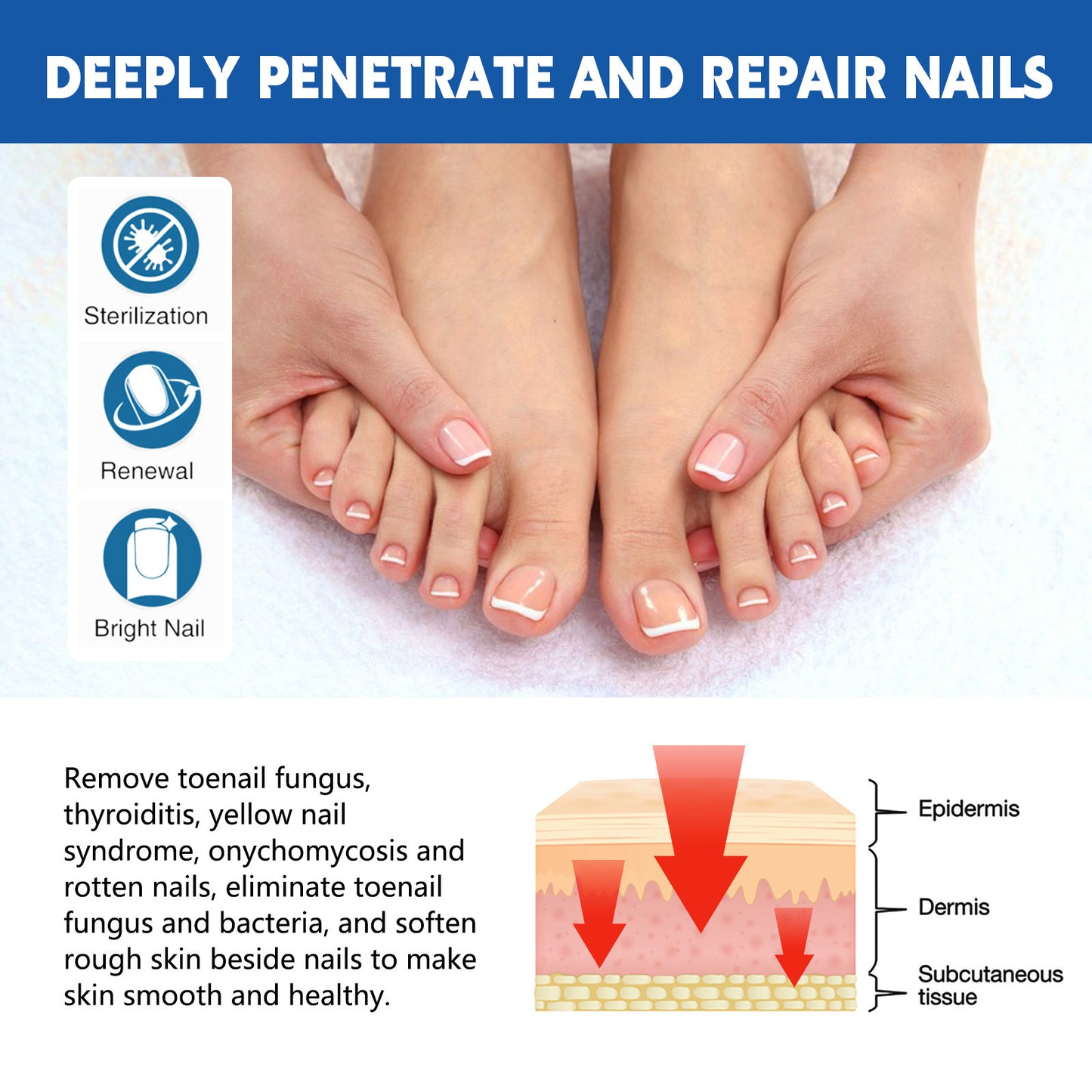 Nail Groove Nursing Adhesive Bandage