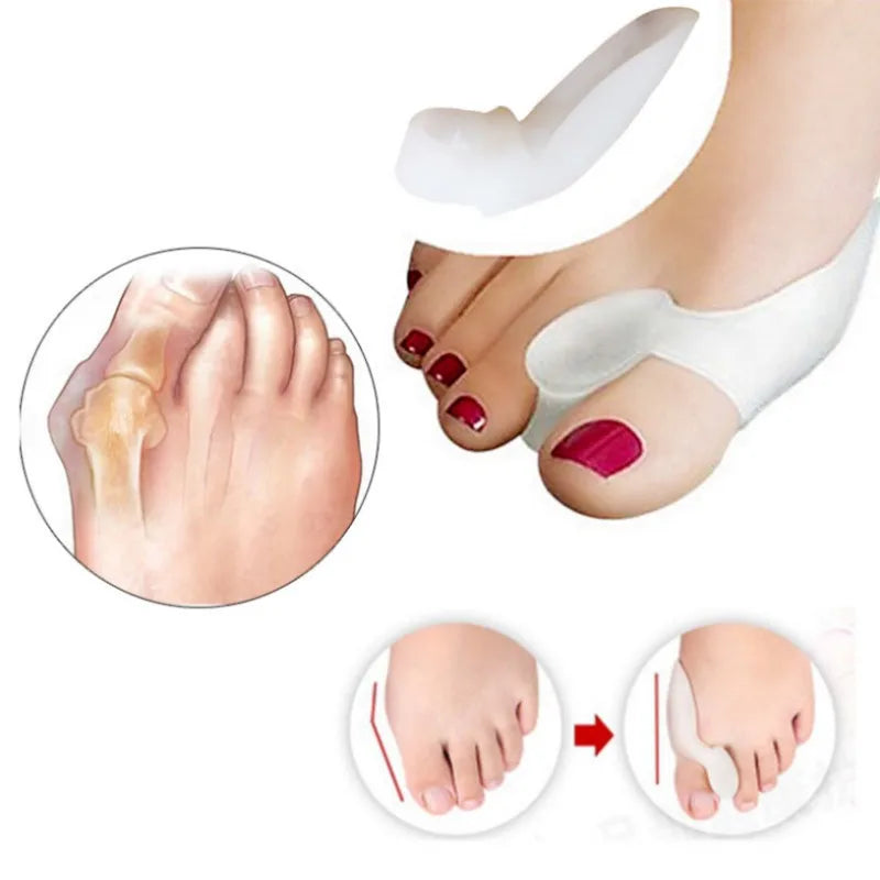 2PCS Silicone Bunion Corrector