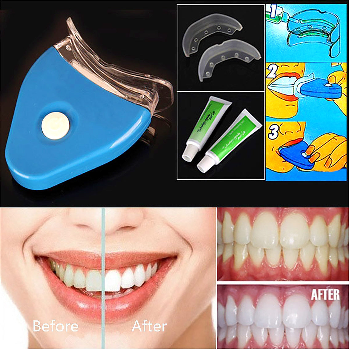 Tooth Whitening Oral Gel